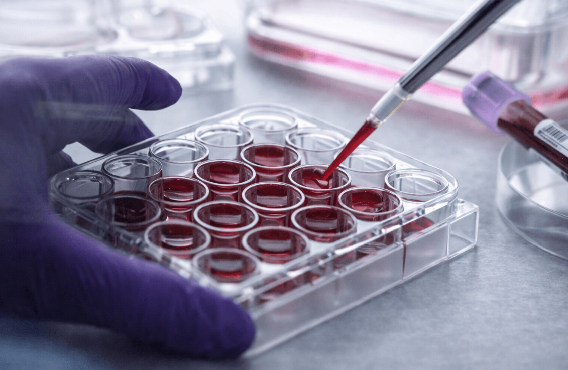 Faut-il acheter l&rsquo;action AB Science en 2026 ? Analyse et avis